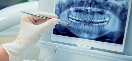 диагностика заболевания зубов