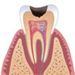 Исследование одного зуба